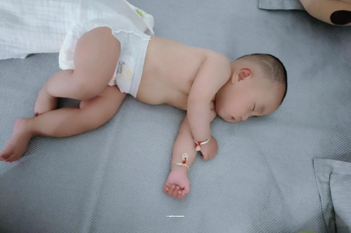 泰兴宝宝头上长痱子
